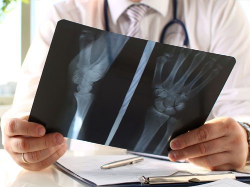 What Injuries are the Most Common Scooter Injuries? What Injuries are the Most Common Scooter Injuries?