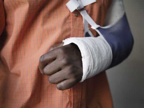How Do You Prove A Dog Bite Case? How Do You Prove A Dog Bite Case?