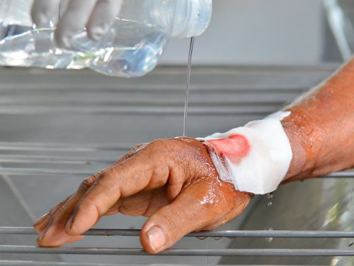Why Are Dog Bites Potentially Dangerous? Why Are Dog Bites Potentially Dangerous?